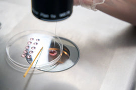 Dingen die Je Moet Weten voordat Je aan Je IVF-Traject Begint